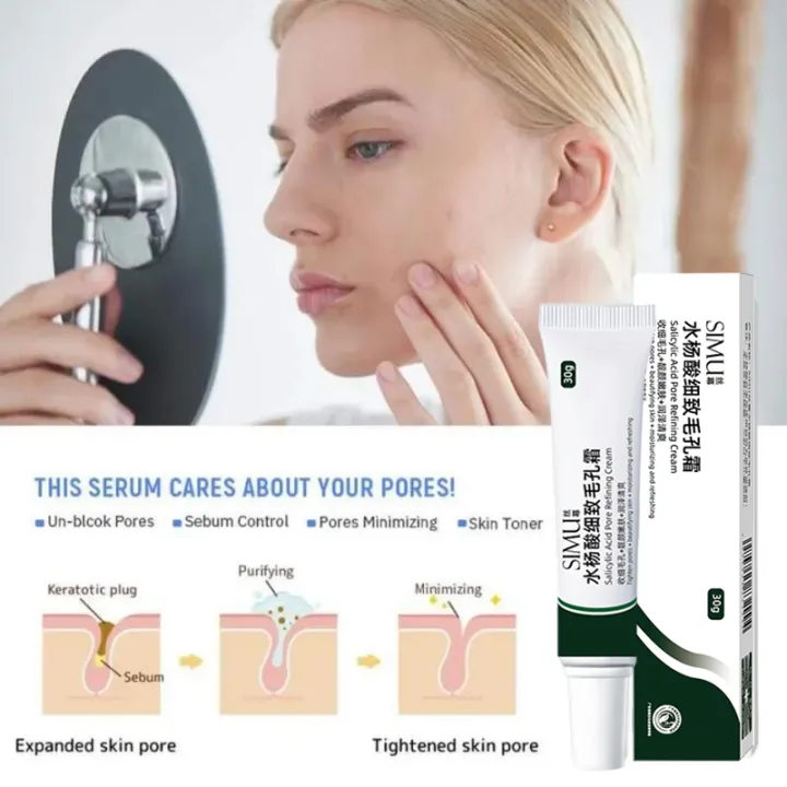 Swanwany%20Salicylic%20Acid%20Pores%20Shrink%20Refining%20Cream%20Repair%20Large%20Open%20Pore%20Remove%20Black%20Dots%20Blackhead%20Acne%20Marks%20Face%20Skin%20Care%20Products%20phone%20case%20-%20Image%206