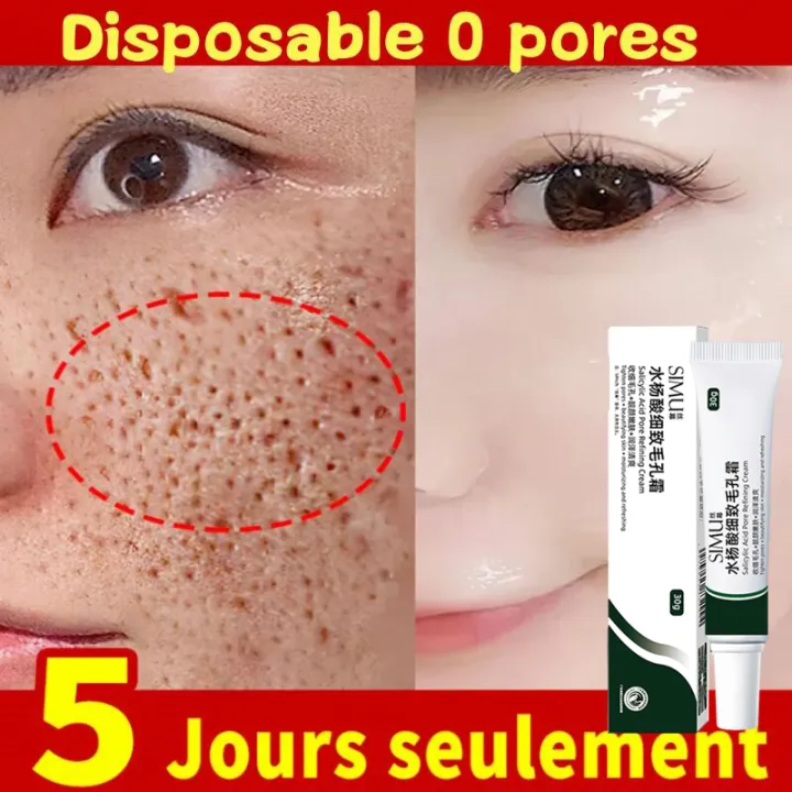 Swanwany%20Salicylic%20Acid%20Pores%20Shrink%20Refining%20Cream%20Repair%20Large%20Open%20Pore%20Remove%20Black%20Dots%20Blackhead%20Acne%20Marks%20Face%20Skin%20Care%20Products%20phone%20case%20-%20Image%204