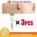 Salicylic Acid Pore Shrinking Cream Quick Elimination Large Pores Remove Blackehead Tighten Face Smooth Skin Korean Care Product.