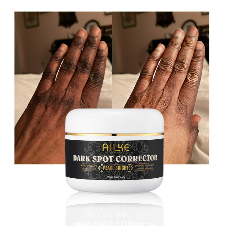 Airline%20Store%20%20AILKE%20Stains%20Remover%20for%20Face,%20Body,%20Underarms,%20Armpit,%20knuckle,%20Knees,%20Elbows,%20Skin%20Lightening%20for%20Women%20and%20Men%20Face%20Cream%20phone%20case%20-%20Image%204