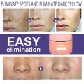 Melasma Remover Cream Removal Dark Pigment Brighten Cream Face Fade Dull Skin Cream Nicotinamide Brightening Moisturize Emulsion. 