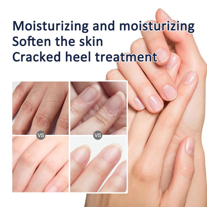 In%20blue%20In%20Whitening%20Hand%20Cream%20Wrinkle%20Remover%20Anti%20crack%20Moisturizing%20Exfoliating%20Repair%20Hand%20Lotion%20Anti%20Aging%20Nourish%20Skin%20Care%20Creams%20phone%20case%20-%20Image%207