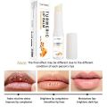 Airline Store  Lip Lightening Balm for Dark Lips Lip Brightener Moisturizing for Smokers Dark Lip Treatment Lightening Cream for Pink Lips phone case. 