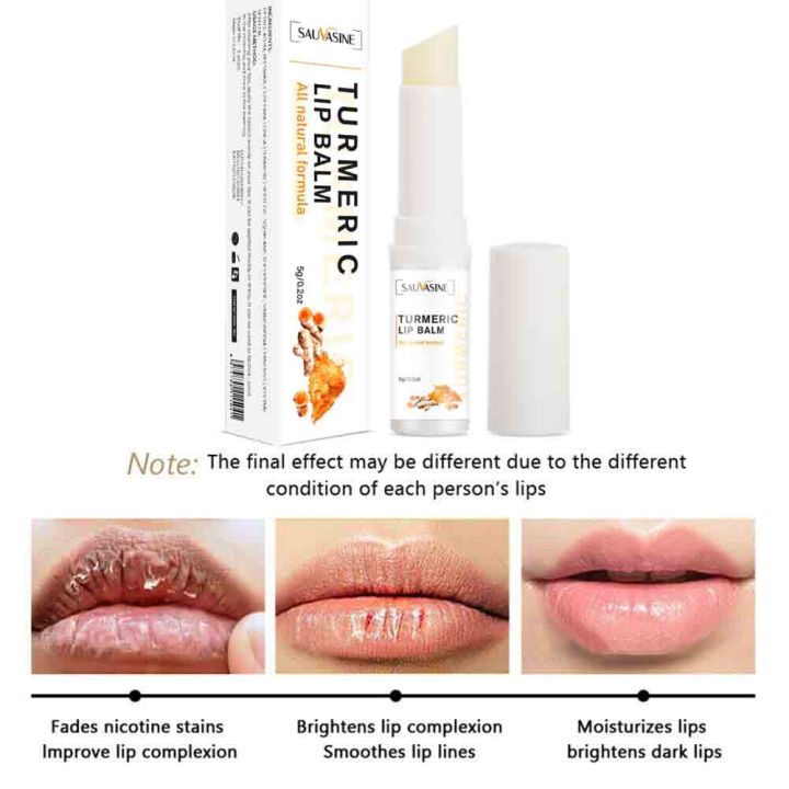 Airline%20Store%20%20Lip%20Lightening%20Balm%20for%20Dark%20Lips%20Lip%20Brightener%20Moisturizing%20for%20Smokers%20Dark%20Lip%20Treatment%20Lightening%20Cream%20for%20Pink%20Lips%20phone%20case%20-%20Image%203