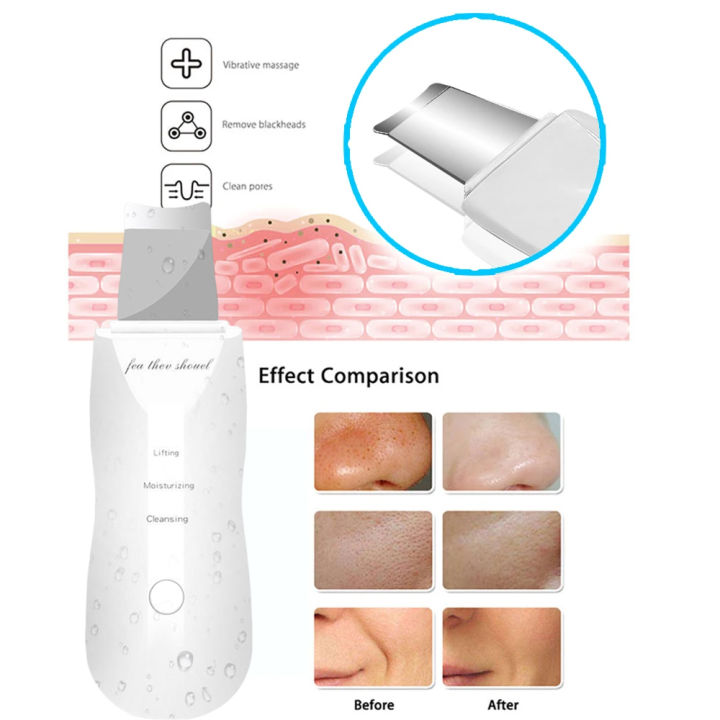 Ultrasonic%20Skin%20Scrubber%20Peeling%20Blackhead%20Remover%20Deep%20Face%20Cleaning%20Skin%20Scrubber%20Acne%20Pore%20Cleaner%20Facial%20Shovel%20Cleanser%20-%20Image%203