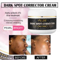 Airline Store AILKE Stains Remover for Face, Body, Underarms, Armpit, knuckle, Knees, Elbows, Skin Lightening for Women and Men Face Cream phone case.