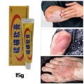 In blue In Sulfur Antibacterial Cream Soap Spray Set Psoriasis Eczema Anti itch Relief Rash Urticaria Desquamation Ointment Body Skin Care phone case.