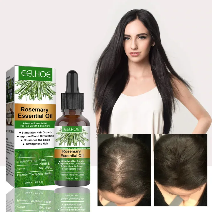 In%20blue%20In%20Rosemary%20Oil%20Nature%20Spell%7Crosemary%20Essential%20Oil%20For%20Hair%20Growth%20-%2030ml%20Natural%20Hair%20Care%20phone%20case%20-%20Image%206