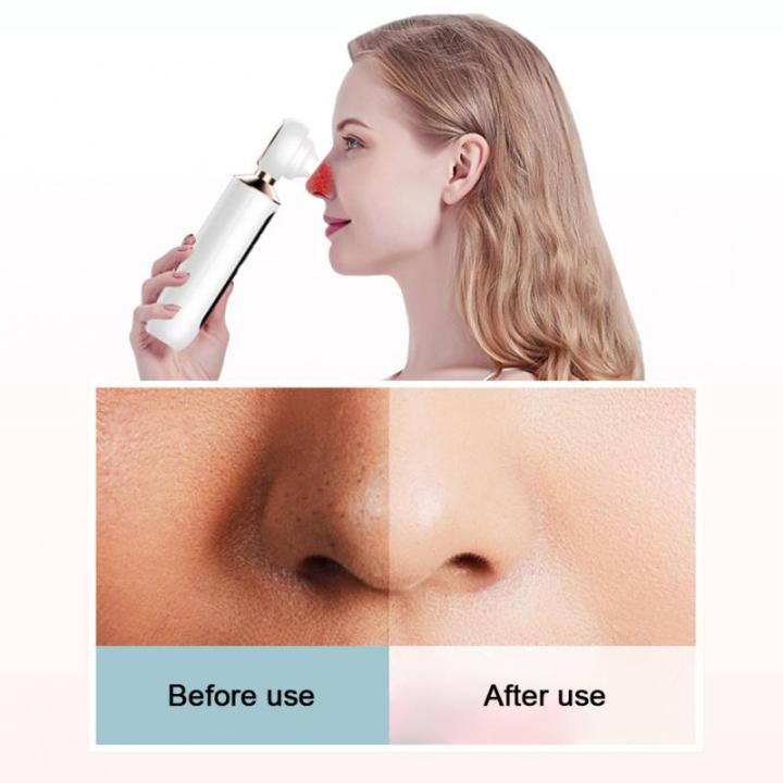 Visual%20Electric%20Facial%20Blackhead%20Remover%20With%20Magnifier%20Acne%20Cleaner%20Black%20Spots%20Removal%20Deep%20Cleansing%20Skin%20Face%20Pore%20Cleaner%20-%20Blackhead%20&%20Blemish%20Removers%20-%20AliExpress%20-%20Image%204