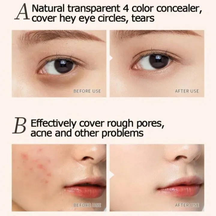 MoupBoi%204%20Color%20Concealer%20Cream%20Palette%20Cover%20Dark%20Circles%20Freckle%20Base%20Cream%20Long%20Lasting%20Moisturizing%20Face%20Concealer%20Foundation%20Makeup%20Phone%20case%20-%20Image%204