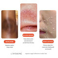 Glutathione Skin Whitening Soap Hand Soap Reduce Pigmentation Fade Black Spot Dead Skin Lightening Brightening Face Glowing Ski. 