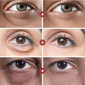 Eyes Bag Remove Collagen Eye Patch Instant Fade Fine Lines Dark Circles Fat Particles Moisturizing Anti Puffiness Korea Eye Care. 