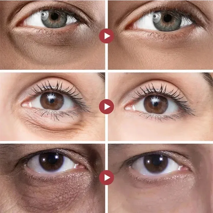 Eyes%20Bag%20Remove%20Collagen%20Eye%20Patch%20Instant%20Fade%20Fine%20Lines%20Dark%20Circles%20Fat%20Particles%20Moisturizing%20Anti%20Puffiness%20Korea%20Eye%20Care%20-%20Image%203