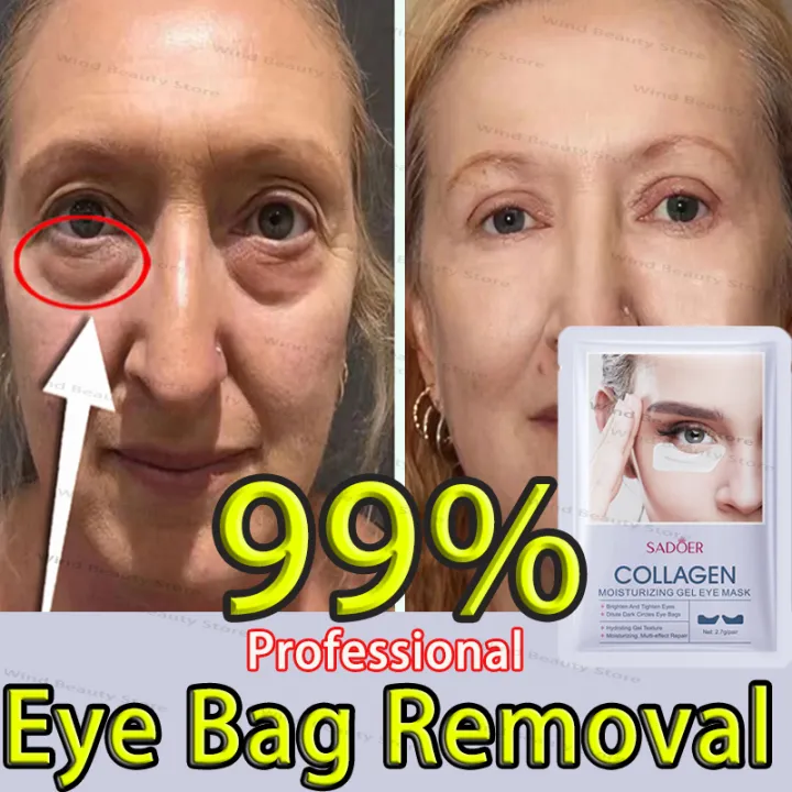 Eyes%20Bag%20Remove%20Collagen%20Eye%20Patch%20Instant%20Fade%20Fine%20Lines%20Dark%20Circles%20Fat%20Particles%20Moisturizing%20Anti%20Puffiness%20Korea%20Eye%20Care%20-%20Image%202