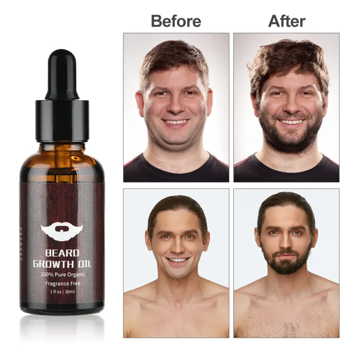 Airline%20Store%20%204pcs/set%20Beard%20Growth%20Kit%20For%20Men%20Hair%20Enhancer%20Thicker%20Mustache%20Grooming%20Beard%20Care%20Oil%20Moisturizer%20Wax%20Balm%20With%20Roller%20Comb%20phone%20case%20-%20Image%206