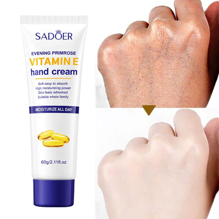 In%20blue%20In%20Whitening%20Hand%20Cream%20Wrinkle%20Remover%20Anti%20crack%20Moisturizing%20Exfoliating%20Repair%20Hand%20Lotion%20Anti%20Aging%20Nourish%20Skin%20Care%20Creams%20phone%20case%20-%20Image%202