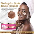 Monologuee Ailke Organic Salicylic Acid Acne Cream, Effectively Defeats Acne-prone Skin, Refreshing, Oil Control, Pimples Remove Face Cream - Creams - AliExpress phone case.
