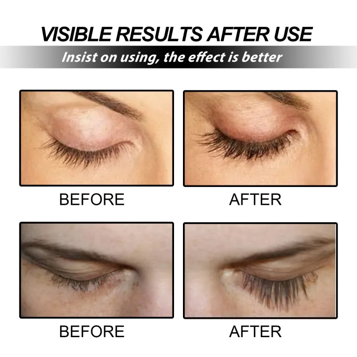 Swanwany%20EELHOE%20Eyelash%20Growth%20Serum%20to%20Grow%20Eyelashes%20Strengthen%20Curling%20Organic%20Castor%20Oil%20Eyelash%20Enhancer%20Serum%20Lengthening%20Eyelashes%20phone%20case%20-%20Image%205
