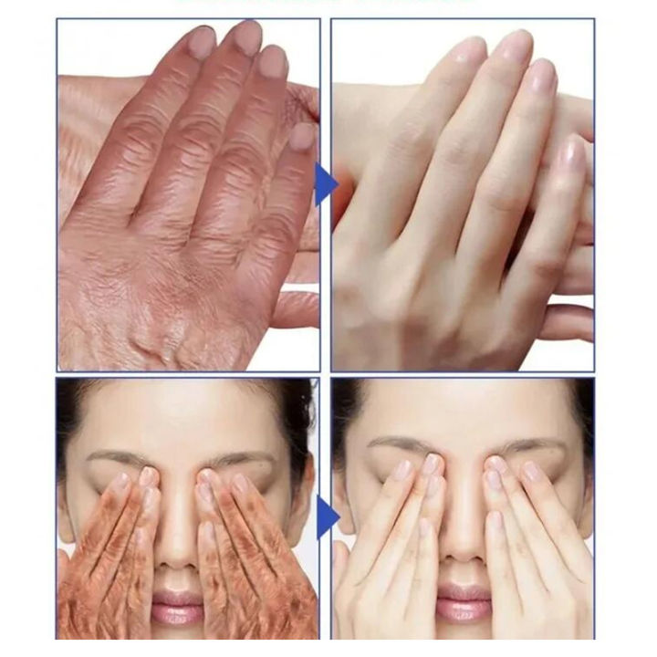 In%20blue%20In%20Whitening%20Hand%20Cream%20Wrinkle%20Remover%20Anti%20crack%20Moisturizing%20Exfoliating%20Repair%20Hand%20Lotion%20Anti%20Aging%20Nourish%20Skin%20Care%20Creams%20phone%20case%20-%20Image%204