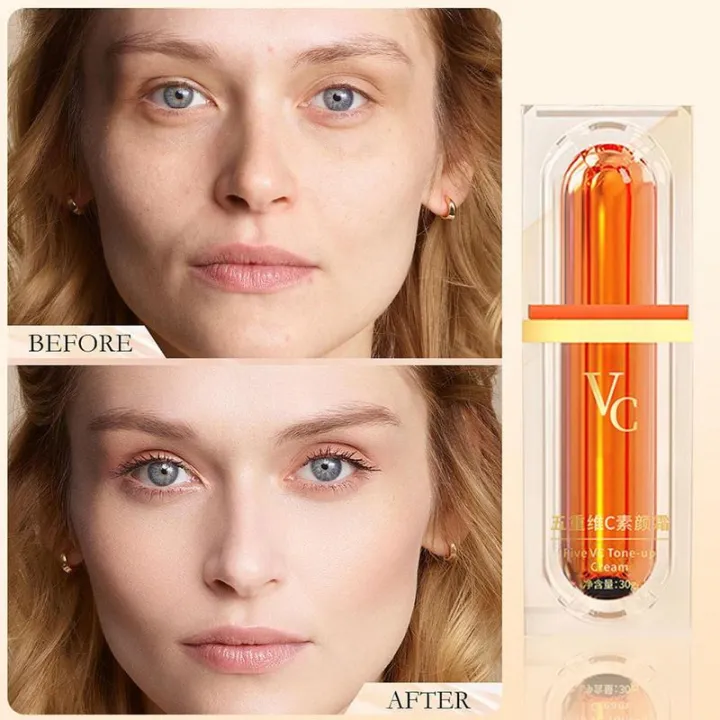 MoupBoi%20Whitening%20Vitamin%20C%20Face%20Cream%20Five%20VC%20Tone%20Up%20Cream%20Moisturizer%20Anti%20Aging%20Pimple%20Wrinkle%20Spots%20Remover%20Brightening%20Skin%20Care%20Phone%20Case%20-%20Image%205