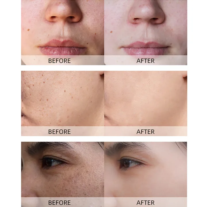 TopZ%20Professional%20Turmeric%20Mud%20Clay%20Face%20Mask%20Whitening%20Vitamin%20C%20Acne%20Treatment%20Dark%20Spots%20Remover%20Deep%20Cleaning%20Brightening%20Cream%20phone%20case%20-%20Image%203
