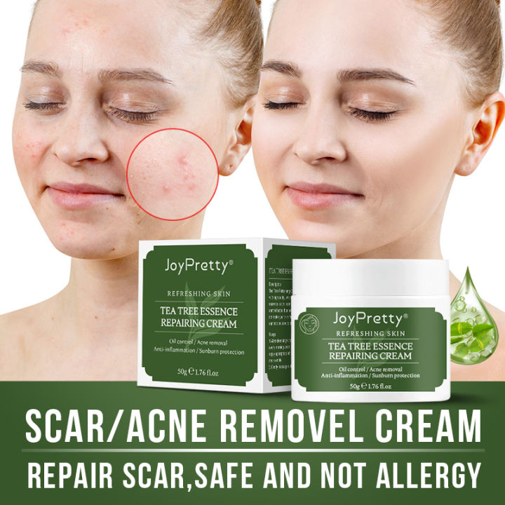 Joypretty%206pcs%20Face%20Skin%20Care%20Set%20Tea%20Tree%20Extract%20Acne%20Removal%20Improve%20Pores%20Face%20Cream%20Cleanser%20Repair%20Korean%20Cosmetics%20Kit%20-%20Facial%20Care%20Sets%20&%20Kits%20-%20AliExpress%20-%20Image%203