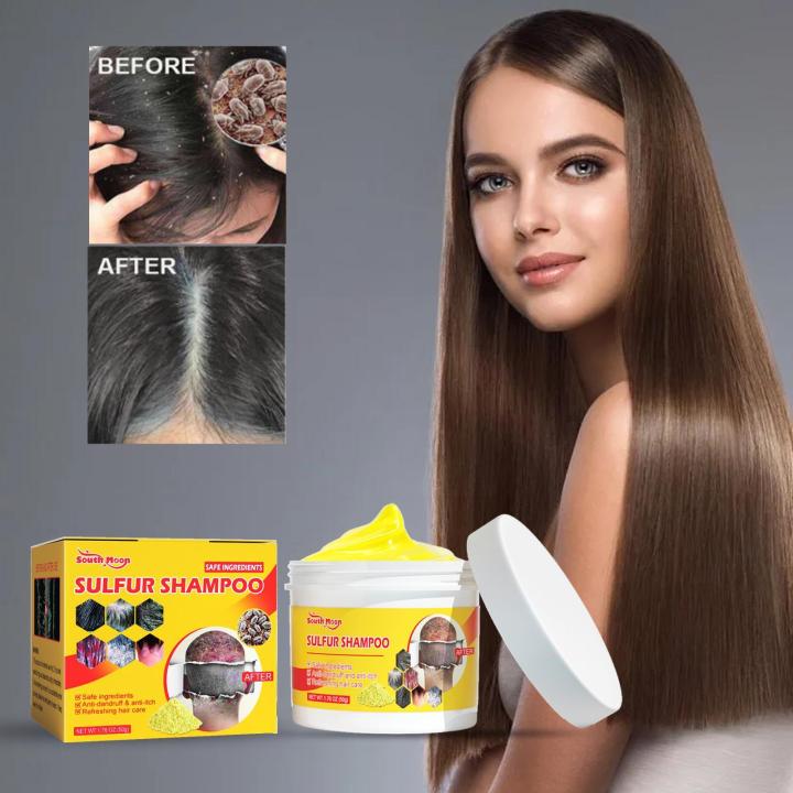 In%20blue%20In%2050g%20Sulfur%20Shampoo%20Remove%20Lice%20Mites%20Dandruff%20Itching%20Oil%20Cleaning%20Scalp%20Deep%20Hair%20Antipruritic%20Follicles%20Cleaning%20Hair%20Care%20phone%20case%20-%20Image%204