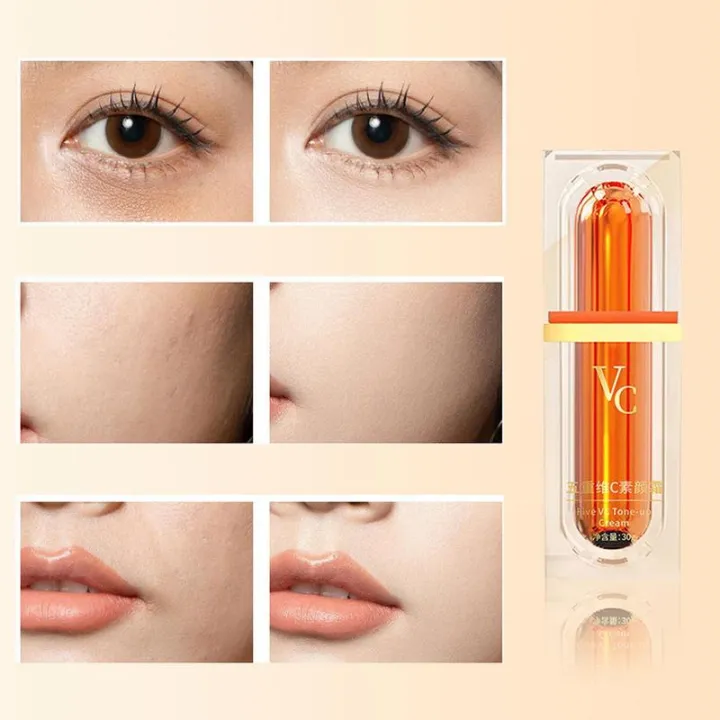 MoupBoi%20Whitening%20Vitamin%20C%20Face%20Cream%20Five%20VC%20Tone%20Up%20Cream%20Moisturizer%20Anti%20Aging%20Pimple%20Wrinkle%20Spots%20Remover%20Brightening%20Skin%20Care%20Phone%20Case%20-%20Image%206