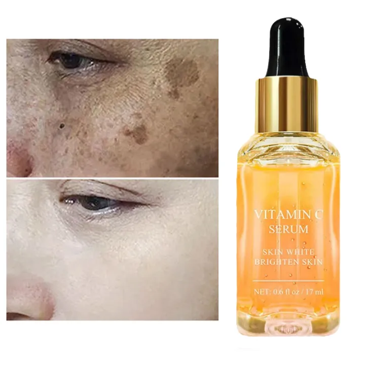 Vitamin%20C%20Therapy%7Cvitamin%20C%20Facial%20Serum%20-%20Anti-aging,%20Dark%20Spot%20Removal,%20Collagen%20Boost%20-%20Image%206