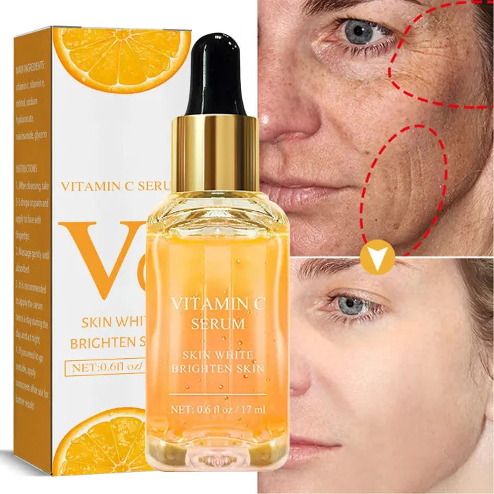 Vitamin%20C%20Therapy%7Cvitamin%20C%20Facial%20Serum%20-%20Anti-aging,%20Dark%20Spot%20Removal,%20Collagen%20Boost%20-%20Image%205