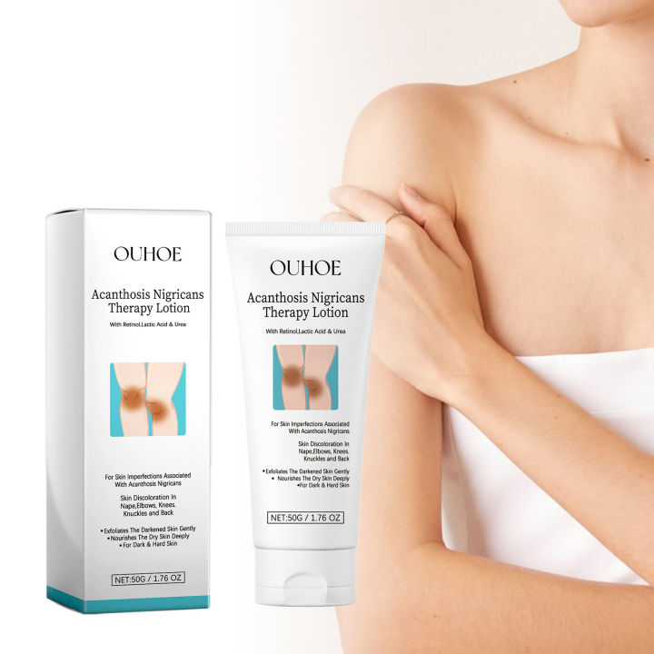 Acanthosis%20Nigricans%20Therapy%20Cream%20Lighten%20Melanin%20Brighten%20Private%20Parts%20Dark%20Neck%20Elbow%20Armpits%20Moisturizing%20Body%20Care%20Lotion%20-%20Image%205