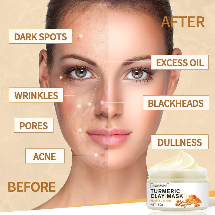 TopZ%20Professional%20Turmeric%20Mud%20Clay%20Face%20Mask%20Whitening%20Vitamin%20C%20Acne%20Treatment%20Dark%20Spots%20Remover%20Deep%20Cleaning%20Brightening%20Cream%20phone%20case%20-%20Image%206