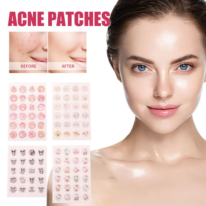Gesh%20Sanrio%20Hello%20Kitty%20Acne%20Pimple%20Patch%20Sticker%20Acne%20Pimple%20Remover%20Tool%20Blemish%20Spot%20Facial%20Mask%20Skin%20Care%20Cartoon%20Hidden%20Pimple%20phone%20case%20-%20Image%205