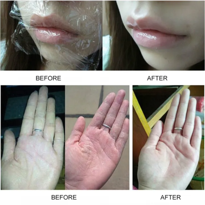 yxzhaoming%20Pure%20Vaseline%20Moisturizing%20Lip%20Balm%20Cream%20For%20Body%20And%20Skin%20Care%20Anti%20Cracking%20Natural%20Plant%20Organic%20Lipbalm%20Korean%20Cosmetics%20-%20Image%206