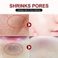 Salicylic Acid Pore Shrinking Cream Quick Elimination Large Pores Remove Blackehead Tighten Face Smooth Skin Korean Care Product.