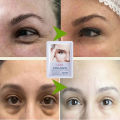 Eyes Bag Remove Collagen Eye Patch Instant Fade Fine Lines Dark Circles Fat Particles Moisturizing Anti Puffiness Korea Eye Care. 