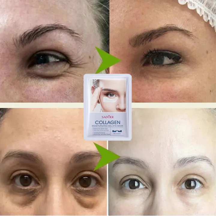 Eyes%20Bag%20Remove%20Collagen%20Eye%20Patch%20Instant%20Fade%20Fine%20Lines%20Dark%20Circles%20Fat%20Particles%20Moisturizing%20Anti%20Puffiness%20Korea%20Eye%20Care%20-%20Image%204