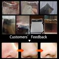 Ultrasonic Skin Scrubber Peeling Blackhead Remover Deep Face Cleaning Skin Scrubber Acne Pore Cleaner Facial Shovel Cleanser. 