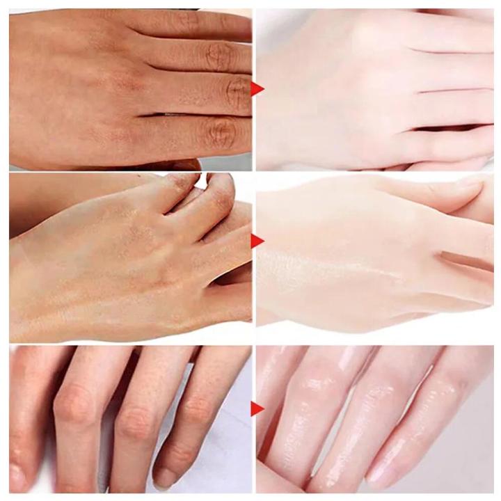 In%20blue%20In%20Whitening%20Hand%20Cream%20Wrinkle%20Remover%20Anti%20crack%20Moisturizing%20Exfoliating%20Repair%20Hand%20Lotion%20Anti%20Aging%20Nourish%20Skin%20Care%20Creams%20phone%20case%20-%20Image%203