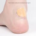 10Pcs Gel Heel Protector Foot Patches Adhesive Blister Pads Heel Liner Shoes Stickers Pain Relief Plaster Foot Care Cushion Grip. 