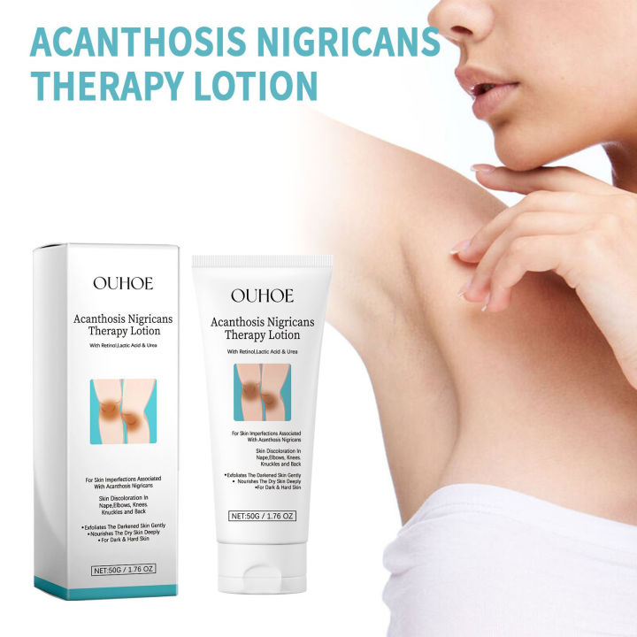 Acanthosis%20Nigricans%20Therapy%20Cream%20Lighten%20Melanin%20Brighten%20Private%20Parts%20Dark%20Neck%20Elbow%20Armpits%20Moisturizing%20Body%20Care%20Lotion%20-%20Image%206