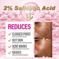 Monologuee Ailke Organic Salicylic Acid Acne Cream, Effectively Defeats Acne-prone Skin, Refreshing, Oil Control, Pimples Remove Face Cream - Creams - AliExpress phone case.
