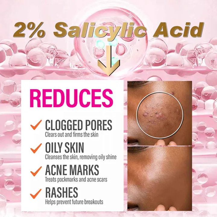 Monologuee%20Ailke%20Organic%20Salicylic%20Acid%20Acne%20Cream,%20Effectively%20Defeats%20Acne-prone%20Skin,%20Refreshing,%20Oil%20Control,%20Pimples%20Remove%20Face%20Cream%20-%20Creams%20-%20AliExpress%20phone%20case%20-%20Image%204