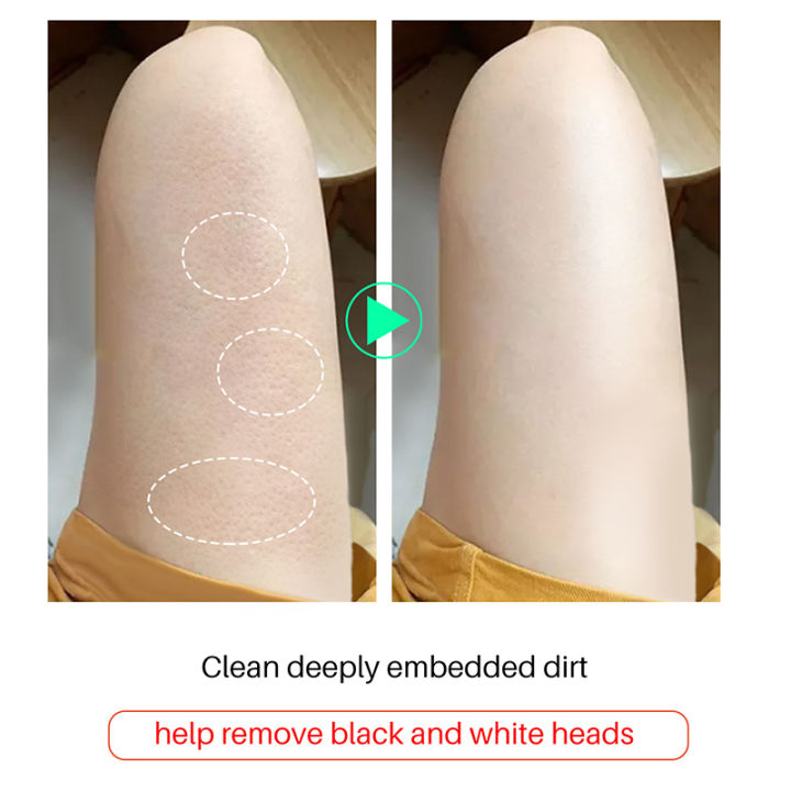 Glutathione%20Skin%20Whitening%20Soap%20Hand%20Soap%20Reduce%20Pigmentation%20Fade%20Black%20Spot%20Dead%20Skin%20Lightening%20Brightening%20Face%20Glowing%20Ski%20-%20Image%207