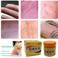 In blue In Sulfur Antibacterial Cream Soap Spray Set Psoriasis Eczema Anti itch Relief Rash Urticaria Desquamation Ointment Body Skin Care phone case.