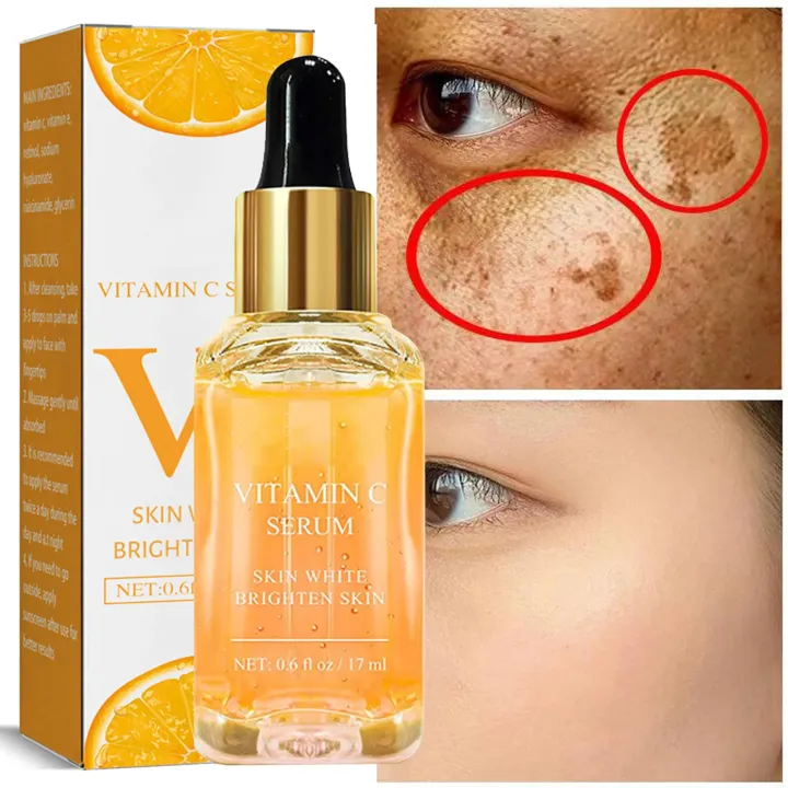 Vitamin%20C%20Therapy%7Cvitamin%20C%20Facial%20Serum%20-%20Anti-aging,%20Dark%20Spot%20Removal,%20Collagen%20Boost%20-%20Image%207