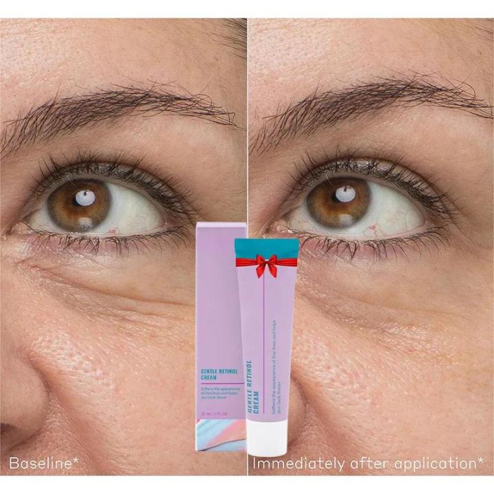 Swanwany%20Repair%20Cream%20Mild%20Retinol%20Night%20Cream%20Awakening%20Eye%20Gel%20Hyaluronic%20Acid%20Caffeine%20Moisturizie%20Essence%20Hydrates%20And%20Lighten%20Spots%20phone%20case%20-%20Image%202