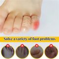 Elasticity Silicone Toe Caps Women Men Gel Little Toe Tube Protector Anti-Friction Handwriting Breathable Foot Care Toes Covers. 