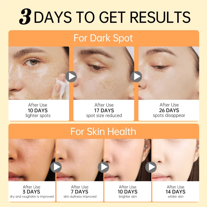 Jellyprim%20Vitamin%20C%20Face%20Cream%20Whitening%20Cream%20for%20Dark%20Skin%20Remove%20Spots%20Acne%20Marks%20Skincare%20Niacinamide%20Brightening%20Anit-Aging%20-%20Image%202