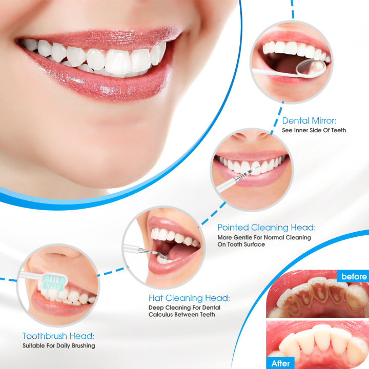 Ultrasonic%20Electric%20Sonic%20Dental%20Scaler%20Stain%20Tartar%20Calculus%20Remover%20Teeth%20Whitening%20Cleaning%20Waterproof%20Electric%20Toothbrush%20-%20Image%205